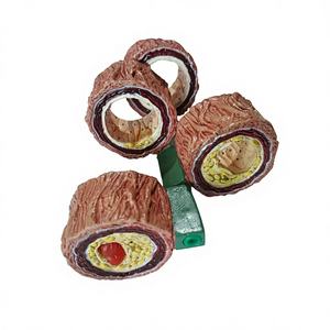 Modelo Anatómico de Arteriosclerosis de 4 Etapas, Material PVC, Modelo Educativo para Escuelas - Product Image 1