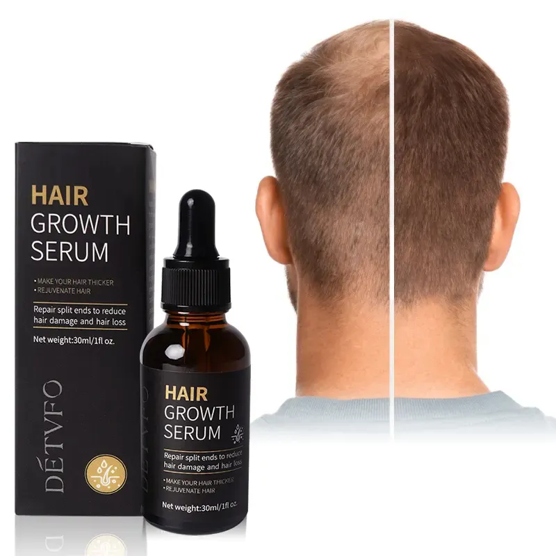 Özel etiket doğal organik Vegan tedavi için kel saç Serum toptan bitkisel Anti saç dökülmesi arttırılması saç büyüme yağı Serum