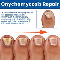 Patchs de réparation rapide et efficace pour les ongles des pieds Ximonth, multi-usages, traitement des ongles incarnés, bandes de traitement des champignons des ongles, patch de correction des ongles des pieds