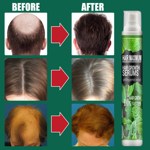 Spray per la crescita dei <span class=keywords><strong>capelli</strong></span> della <span class=keywords><strong>luna</strong></span> del sud prodotti per uomo donna olio per ricrescita rapida trattamento del cuoio capelluto dei <span class=keywords><strong>capelli</strong></span> crescita dei <span class=keywords><strong>capelli</strong></span> bellezza salute - Product Image 6