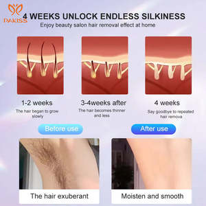 Épilateur laser portable IPL portable avec <span class=keywords><strong>lumière</strong></span> <span class=keywords><strong>pulsée</strong></span> de 999999 flashs pour femmes - Product Image 3