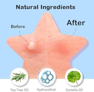 Parches Adhesivos para el Acné al por Mayor OEM, Parches Anti-Espinillas, Lindo Estuche con Espejo - Product Image 4