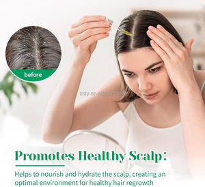 Desobstruye los Poros, Reduce las <span class=keywords><strong>Cicatrices</strong></span> del Acné, <span class=keywords><strong>Aceite</strong></span> Natural <span class=keywords><strong>de</strong></span> Bergamota, Vitamina C, Reduce la Caspa y Calma la Picazón del Cuero Cabelludo Graso - Product Image 3