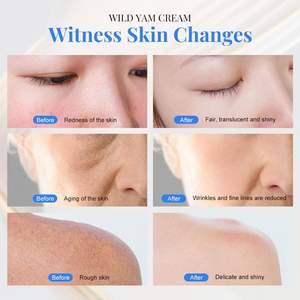 Krim ubi liar Label pribadi alami untuk hormon keseimbangan ekstrak akar ubi liar Perawatan Kulit untuk CNY kering - Product Image 4