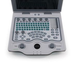 Kualitas tinggi portabel warna Doppler <span class=keywords><strong>Ultrasound</strong></span> System Rumah Sakit <span class=keywords><strong>Ultrasound</strong></span> Scanner - Product Image 3