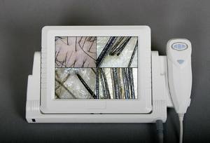 MC-A01 त्वचा और निष्पक्ष विश्लेषक/सरल ऑपरेशन वीडियो <span class=keywords><strong>dermatoscope</strong></span> चीन - Product Image 3