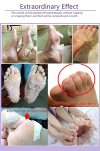 Cura della pelle del piede maschera esfoliante per i piedi calzini per Pedicure esfoliazione per i piedi maschera rimuovi pelle morta tacchi piedi Peeling maschera per la buccia - Product Image 3