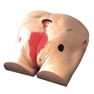 Modelo de Cuidado de Úlceras por Decúbito de 4 Etapas para Entrenamiento de Enfermería H-10, Modelo Médico para el Cuidado de Úlceras por Decúbito - Product Image 6