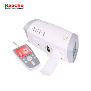 กล้องวิดีโอโคโลสโคปแบบพกพาสำหรับนรีเวชวิทยา กล้องวิดีโอตรวจปากมดลูก กล้องส่องตรวจทางนรีเวช - Product Image 3