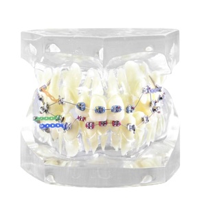 Modello dentale Denxy con staffa metallica legatura legatura catena elastica orto Typodont dentale per trattamento di dimostrazione ortodontica - Product Image 1