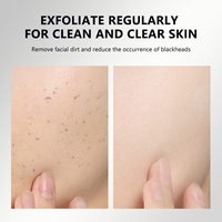 Sérum Ampoule Exfoliant au Riz Noir Marque Blanche – Essence Contrôle Sébum, Aide à Réduire le Sébum, Équilibre la Peau, Affine les Pores, Sérum Visage