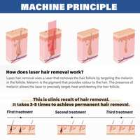 Mesin Penghilang Bulu Laser Diode Peremajaan Kulit Triple Wavelength 1200W Perfectlaser Clinic AI Skin Analyzer
