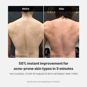 MEDICUBE ครีมอาบน้ำลดสิวสีแดง 400 กรัม ผลิตภัณฑ์ดูแลผิวจากเกาหลี ครีมอาบน้ำผิวขาว พร้อมฟองนุ่ม สำหรับผู้ใหญ่ ดูแลผิวที่มีแนวโน้มเป็นสิว - Product Image 4