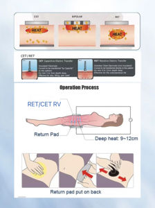 Máquina de <span class=keywords><strong>Diatermia</strong></span> Profesional para Fisioterapia, Alivio del Dolor, 448khz, Máquina de Belleza y Adelgazamiento - Product Image 3