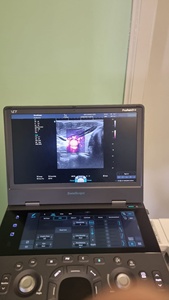 Nuevo Sistema de Diagnóstico por Ultrasonido Sonoscape Propet E11 2025, Doppler Color, Ecocardiografía, Ultrasonido Veterinario y Humano - Product Image 6