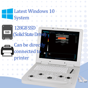Portátil CU3 Laptop Full Digital Diagnóstico Color Doppler Ultrasonido para humanos Equipo de diagnóstico - Product Image 5