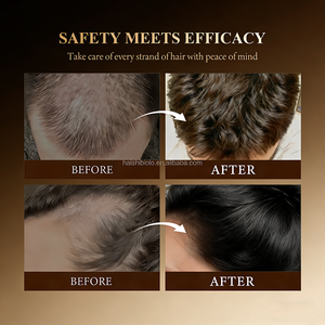 แชมพูบำรุงรากผมสูตรควบคุมความมัน ป้องกันผมร่วง บำรุงเส้นผมให้แข็งแรง ด้วยสารสกัดจากโสม สำหรับผู้ชายและผู้หญิง - Product Image 4