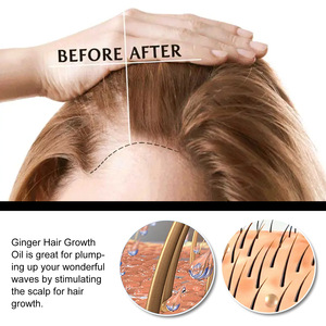 Holesale-bolsa de aire OSS ymptoms, sistema de ventilación resistente - Product Image 4