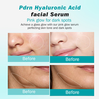 Sérum Visage Acide Hyaluronique PDRN Marque Blanche Hydratation Intense pour Apaiser les Rougeurs, Maintenir la Stabilité et Réparer les Peaux Fragiles – Sérum OEM