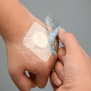 Membran Pelindung Luka Transparan Tahan Air PU Bersertifikat CE, Perekat Medis Jaring Sekali Pakai, Bahan Jahitan Kelas I - Product Image 6