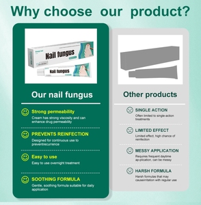 20g Formula Herbal Alami Bersertifikat CE Kelas I Krim Antibakteri untuk Jamur Kuku dengan Masa Simpan 3 Tahun Buatan Cina - Product Image 6