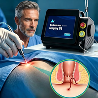 Appareil laser médical pour hémorroïdes, laser diode 980 nm 1470 nm, traitement chirurgical des fistules, dispositif de proctologie