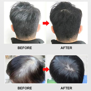 จิ๋ยอิ่ง แฮร์คัลเลอร์สมุนไพรแอปเปิ้ล 72 สีดำธรรมชาติ ครีมแชมพู 30 มล.*10 ขวด  แบบกึ่งถาวร ปราศจากแอมโมเนีย ปิดผมขาว - Product Image 4