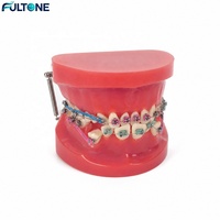 Fultone Dental : Modèle d'orthodontie éducatif très demandé pour la démonstration dentaire et les cours de dentisterie