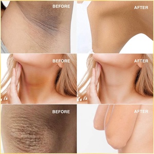 Jabón Facial Personalizado con Ácido Kójico para Eliminar Manchas Oscuras, Jabón Natural en Barra de Marca Privada, Fabricante OEM, Jabón Facial Limpiador Sólido de Cúrcuma - Product Image 3