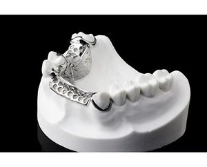 Resina Dental BlueCast para Impresora 3D LCD, 0.5 kg, Precisión Extrema, Estabilidad Dimensional, Italia - Product Image 3