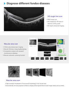 Equipo de Diagnóstico Oftalmológico con Función de Análisis de Campo Amplio, Angiografía, Tomografía de Coherencia Óptica HS-300 - Product Image 2
