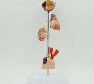 Model Anatomi Kaki Diabetik Ilmu Kedokteran Menunjukkan Pola <span class=keywords><strong>Diabetes</strong></span> Termasuk Pola Organ Patologis - Product Image 6