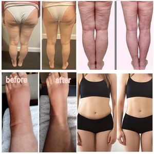 Aparato de instrumento de belleza de electroestimulación para presoterapia ocular, máquina de pantalon profesional - Product Image 2