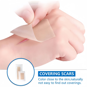 Hysent 1.57 ''x 59'' Grand Patch en gel de <span class=keywords><strong>silicone</strong></span> <span class=keywords><strong>Cicatrice</strong></span> Ruban médical épais Bandage Patch en <span class=keywords><strong>silicone</strong></span> Bande de <span class=keywords><strong>cicatrice</strong></span> en <span class=keywords><strong>silicone</strong></span> pour cicatrices - Product Image 5