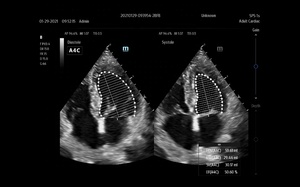 Système d'échographie Doppler couleur TE9 de qualité supérieure pour diagnostic vétérinaire avec fonctionnement stable - Product Image 5