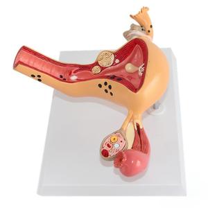 Model pengajaran medis Model anatomi ologis & petrokimia manusia untuk pendidikan ginekologi - Product Image 5