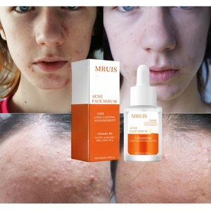 30ml Premium yüz serumu adanmış akne kaldırma ustalıkla formüle pürüzsüz yoğun cilt derinden tutarken gözenekleri rafine - Product Image 1