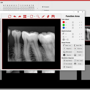 Most Popular Dental X Unit Sensor X Machine Portable High-definition Display X Sensor - Product Image 2