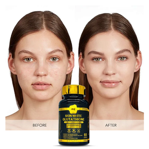 Capsule di L-Glutatione in Offerta, Pillole Sbiancanti per la Pelle, Integratori per l'Invecchiamento Sano, <span class=keywords><strong>Vitamina</strong></span> <span class=keywords><strong>C</strong></span> Vegana, Collagene, Capsule di L-Glutatione - Product Image 4