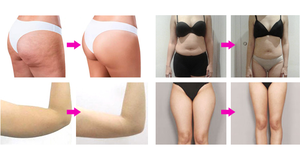 Nouvelle Arrivée 8d Machine Minceur Equip Endo Ball 360 Rotation Sphères Thérapie Sphères Corps Sculptant Rouleau De Massage - Product Image 5