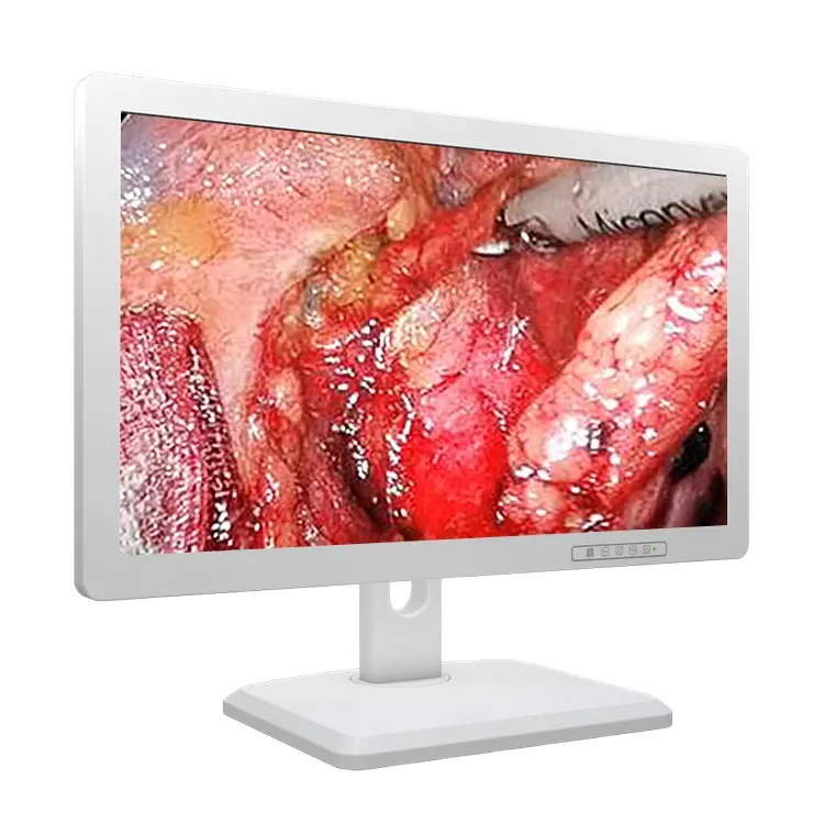 רפואי כיתה צג מחשב מחשב 4k תמונות מערכת 55 אינץ עבור אנדוסקופ ניתוח