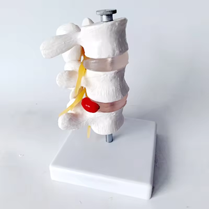 SCIEDU 3 vertebra cakram Lumbar manusia Model anatomi manusia herniasi tulang belakang vertebra dapat dilepas untuk Chiropractor - Product Image 3