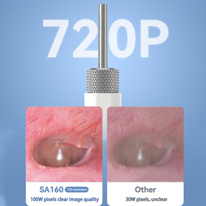 Advanced Electronic <b>Ear</b> Cleaning Otoscope Visual Earpick Earwax Remover Tool with <b>Camera</b> - Product Image 6