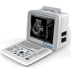 Special Design Full Digital LED Machine <b>Pocket</b> Portable Laptop Veterinary Ultrasound Scanner High-capacity Video Replay BW300 - Product Image 4
