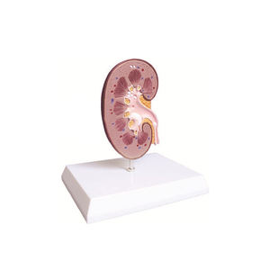 דגם כליות ואבן בכליות גובה 145(מ\"מ) SMD06419 - Product Image 5