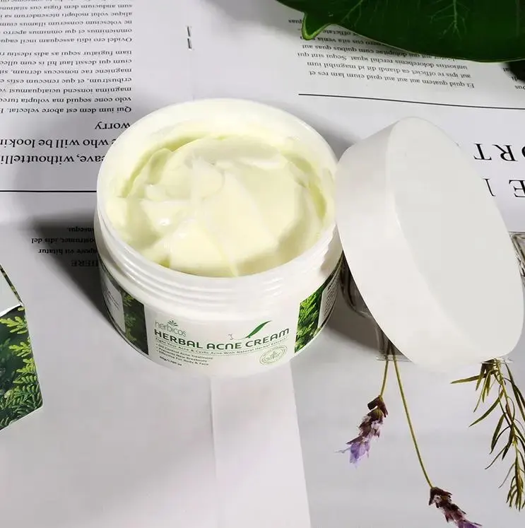 Herbicos Beauty Care Hot Sale Herbal Acne Cream Removal Anti Pimple Blackhead Spot Oil Control Skin Acne Removal Cream For Face