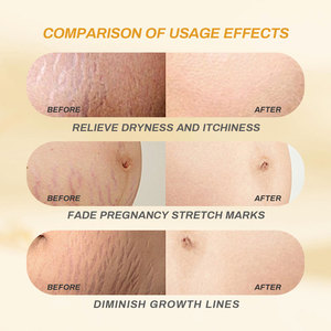 Huile <span class=keywords><strong>anti</strong></span>-vergetures 100% naturelle, sur mesure, en gros, qui raffermit et répare la peau - Product Image 5