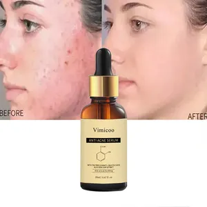 Beauty Private Label Herbal Vegan Face Skin Care Repairing Tea Tree Salicylic Acid Anti Acne Remover Treatment Serum Essence