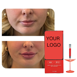 Filler Labbra Rosso da 1ml con Vitamina B12 e <span class=keywords><strong>Acido</strong></span> <span class=keywords><strong>Ialuronico</strong></span> per Labbra Naturalmente Morbide, Voluminose e Luminose - Product Image 5