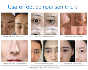 Nouvelle technologie oxygène Jet peel Machine de soins de la peau oxygène Jet d'eau Peel Machine faciale Hydrodermabrasion équipement facial - Product Image 5